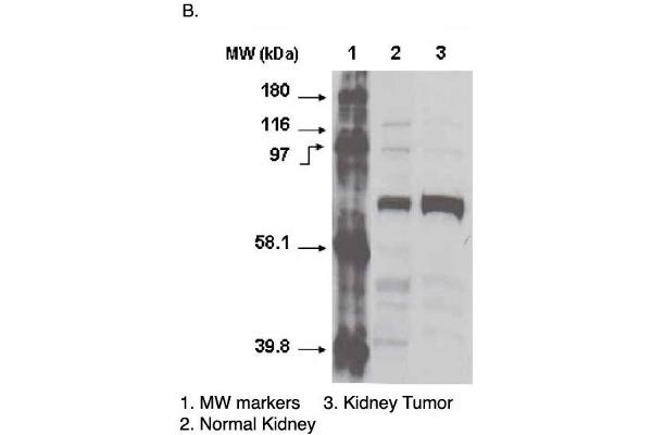 CYP4F11 antibody  (C-Term)