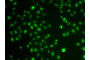 Immunofluorescence analysis of MCF-7 cells using POU6F1 antibody. (POU6F1 antibody)