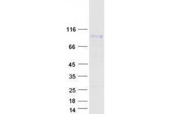 WEE1 Protein (Transcript Variant 1) (Myc-DYKDDDDK Tag)