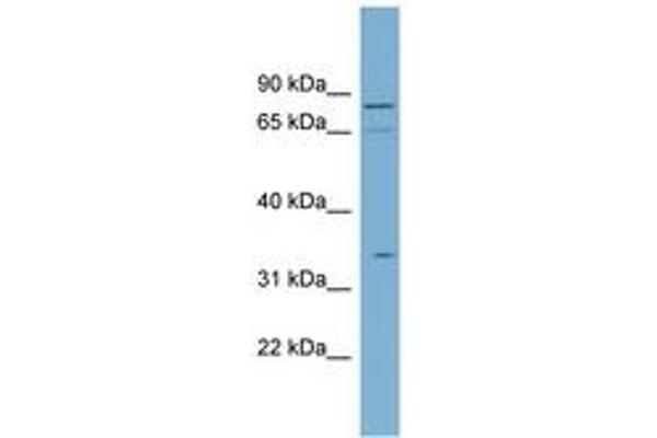 SLC5A9 antibody  (N-Term)