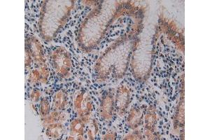 IHC-P analysis of stomach tissue, with DAB staining. (Keratin 3 antibody  (AA 198-514))