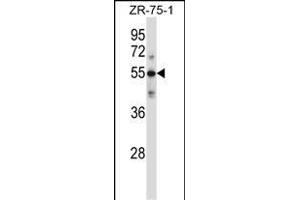 Western Blotting (WB) image for anti-Complement Component C9 (C9) (AA 191-220), (Center) antibody (ABIN657704)