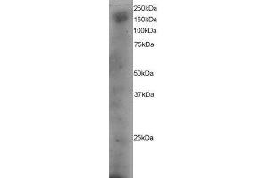 ABIN2562268 staining (4µg/ml) of A431 lysate (RIPA buffer, 35µg total protein per lane). (DOCK1 antibody  (C-Term))