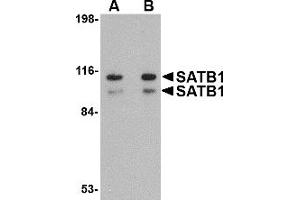 Western Blotting (WB) image for anti-SATB Homeobox 1 (SATB1) (N-Term) antibody (ABIN1031554) (SATB1 antibody  (N-Term))