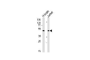 Western blot analysis of lysates from human brain tissue lysate and Jurkat cell line (from left to right), using CHN1 Antibody (N-term) (ABIN1881198 and ABIN2839098). (CHN1 antibody  (N-Term))