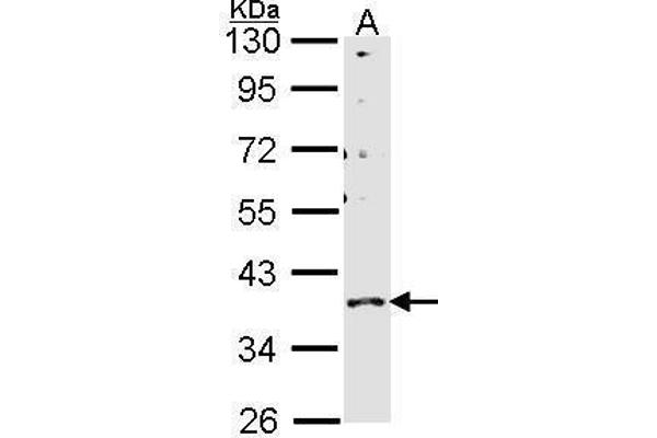 GPR146 antibody