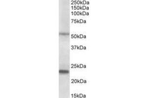 Image no. 1 for anti-Matrix Metallopeptidase 3 (Stromelysin 1, Progelatinase) (MMP3) (AA 459-473) antibody (ABIN1103067) (MMP3 antibody  (AA 459-473))