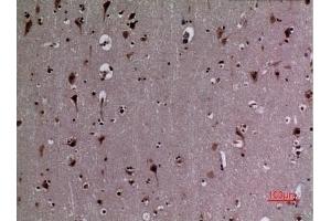 Immunohistochemical analysis of paraffin-embedded human-brain, antibody was diluted at 1:100. (HSP90 antibody  (acLys284, acLys292))