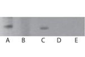 TLR7 Western Blot. (TLR7 antibody)