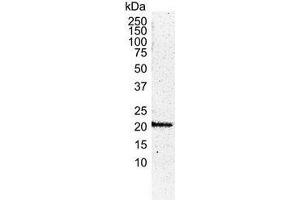 Western Blotting (WB) image for anti-HRas proto-oncogene, GTPase (HRAS) antibody (ABIN2473919) (HRAS antibody)