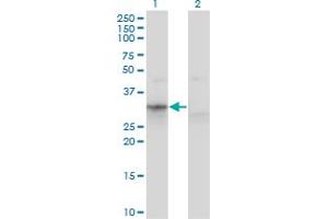 Western Blotting (WB) image for anti-Apolipoprotein F (APOF) (AA 37-327) antibody (ABIN598540) (Apolipoprotein F antibody  (AA 37-327))