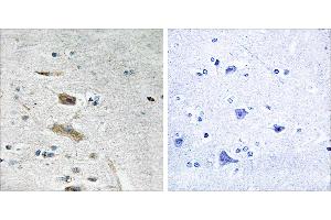 Peptide - +Immunohistochemistry analysis of paraffin-embedded human brain tissue using ABHD4 antibody. (ABHD4 antibody)