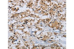 Immunohistochemistry of Human brain  using CMTM8 Polyclonal Antibody at dilution of 1:40 (CMTM8 antibody)