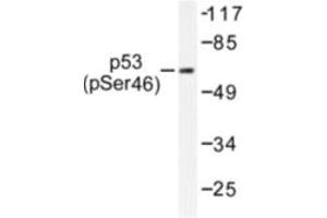 Image no. 1 for anti-Tumor Protein P53 (TP53) (pSer46) antibody (ABIN318094) (p53 antibody  (pSer46))