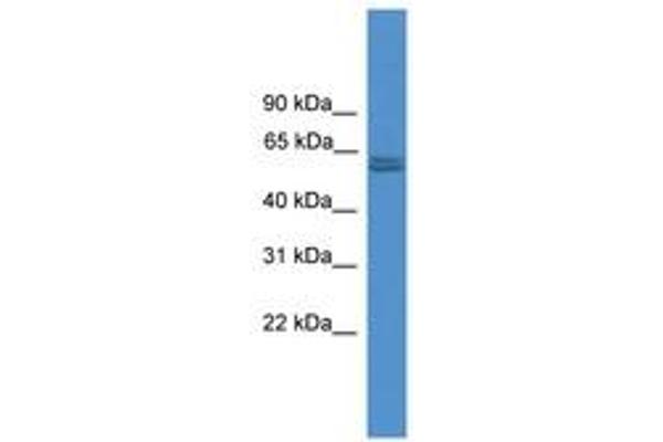 Pyruvate Kinase, Muscle (PKM) (N-Term) anticorps