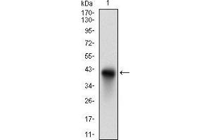 Western Blotting (WB) image for anti-HLA-DR-gamma (CD74) (AA 1-106) antibody (ABIN1724871)