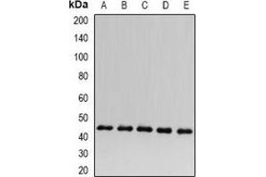 Western blot analysis of ACADS expression in HepG2 (A), Hela (B), mouse kidney (C), rat heart (D), rat liver (E) whole cell lysates. (ACADS antibody)