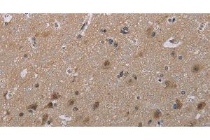 Immunohistochemistry of paraffin-embedded Human brain tissue using MAL Polyclonal Antibody at dilution 1:30 (MAL antibody)