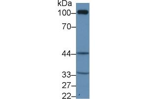 Western Blot; Sample: Rat Kidney lysate; Primary Ab: 1µg/ml Rabbit Anti-Human TP Antibody Second Ab: 0. (TBXA2R antibody  (AA 3-324))