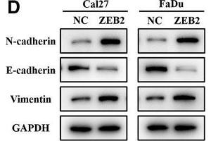 Western Blotting (WB) image for anti-Vimentin (VIM) antibody (ABIN2854814)