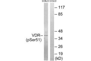 Western Blotting (WB) image for anti-Vitamin D Receptor (VDR) (pSer51) antibody (ABIN1847668) (Vitamin D Receptor antibody  (pSer51))