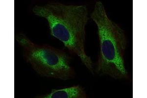 Immunofluorescence (IF) image for anti-Signal Transducer and Activator of Transcription 5A (STAT5A) (AA 583-794) antibody (ABIN1098129)