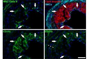 Immunostaining (ISt) image for anti-Perilipin 2 (PLIN2) (AA 1-29), (N-Term) antibody (ABIN285650)