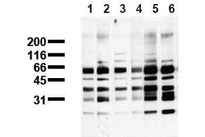 Western Blotting (WB) image for anti-Phosphoserine (phosphorylated) antibody (ABIN126862) (Phosphoserine antibody  (phosphorylated))