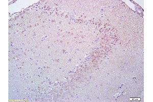 Formalin-fixed and paraffin embedded rat brain tissue labeled with Anti-Brdu Polyclonal Antibody, Unconjugated  at 1:200, followed by conjugation to the secondary antibody and DAB staining (BrdU antibody)