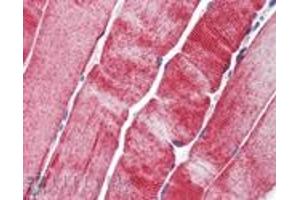 Immunohistochemistry analysis of human skeletal muscle tissue stained with HSP27, mAb (G3. (HSP27 antibody)