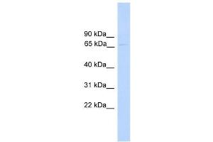 PARP6 antibody used at 1. (PARP6 antibody  (N-Term))