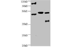 All lanes:Mouse anti-human ENO2 monoclonal antibody at 1 μg/mL Lane 1:Hela cell lysate Lane 2:Recombinant Human Gamma-enolase(ENO2) at 10 μg Lane 3:U251 cell lysate Secondary Goat polyclonal to Mouse IgG at 1/3000 dilution Predicted band size : 43,48 kD Observed band size: 48 kD Additional bands at : 100 kDa. (ENO2/NSE antibody)