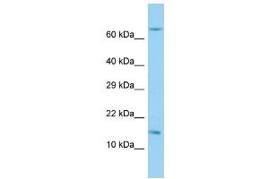 Host: Rabbit Target Name: RPL36AL Sample Type: Hela Whole Cell lysates Antibody Dilution: 1. (RPL36AL antibody  (C-Term))
