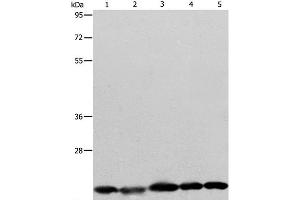Western Blot analysis of Human brain malignant glioma tissue, MCF7, Raji, Lovo and 293T cell using BAX Polyclonal Antibody at dilution of 1:426 (BAX antibody)