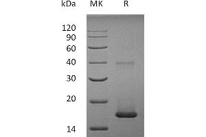 Greater than 95 % as determined by reducing SDS-PAGE. (IL1F10 Protein)