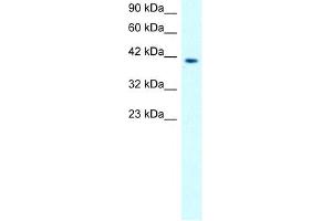 MMP19 antibody used at 0. (MMP19 antibody  (N-Term))