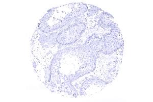 testis (Recombinant Cytokeratin 7 antibody  (AA 1-100))