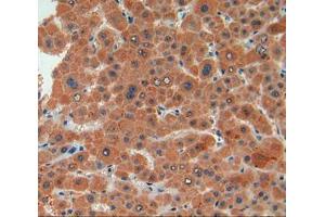 IHC-P analysis of liver tissue, with DAB staining. (Biglycan antibody  (AA 48-158))