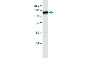 Immunoprecipitation of HK1 transfected lysate using rabbit purified polyclonal anti-HK1 and Protein A Magnetic Bead ( U0007 ), and immunoblotted with mouse purified polyclonal anti-HK1. (HK1 (Human) IP-WB Antibody Pair)