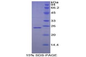 SDS-PAGE analysis of Dog Noggin Protein. (NOG Protein)