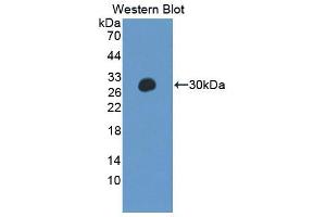 Figure. (PTPN14 antibody  (AA 1-188))