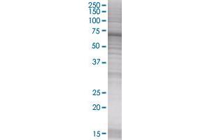 UCP2 transfected lysate. (UCP2 293T Cell Transient Overexpression Lysate(Denatured))