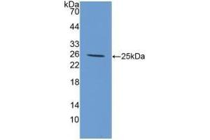 Detection of Recombinant IL6, Canine using Polyclonal Antibody to Interleukin 6 (IL6) (IL-6 antibody  (AA 18-207))