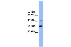 IQCD antibody used at 1 ug/ml to detect target protein. (IQCD antibody  (Middle Region))