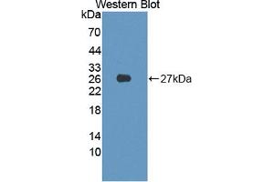 Figure. (PIM2 antibody  (AA 82-291))