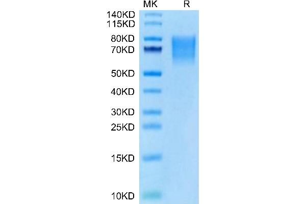 IBSP Protein (AA 17-318) (His tag)