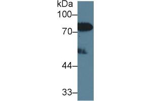 Detection of LBP in Human Serum using Polyclonal Antibody to Lipopolysaccharide Binding Protein (LBP) (LBP antibody  (AA 27-481))