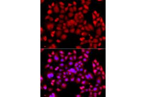 Immunofluorescence analysis of A549 cells using PIP4K2B antibody (ABIN6292246). (PIP4K2B antibody)