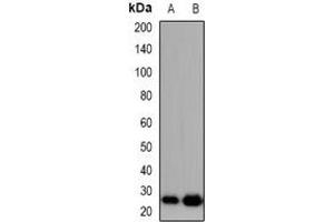 Western blot analysis of TIMP4 expression in Hela (A), NIH3T3 (B) whole cell lysates. (TIMP4 antibody  (C-Term))