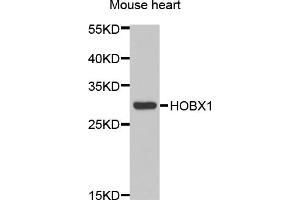 Western blot analysis of extracts of mouse heart, using HOXB1 antibody. (HOXB1 antibody)